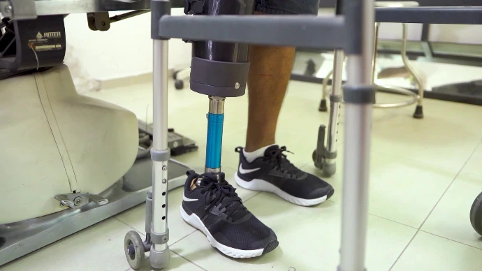 Prótesis Pierna Rodilla Pie Barato