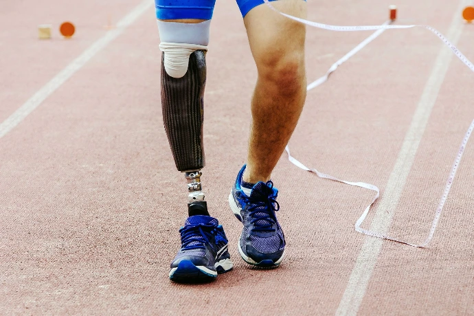 Prótesis autoajustable con socket express, vista lateral mostrando alineación y soporte para caminar